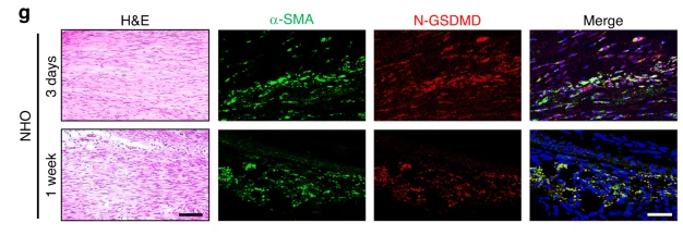 GSDMD Antibody - Fig.